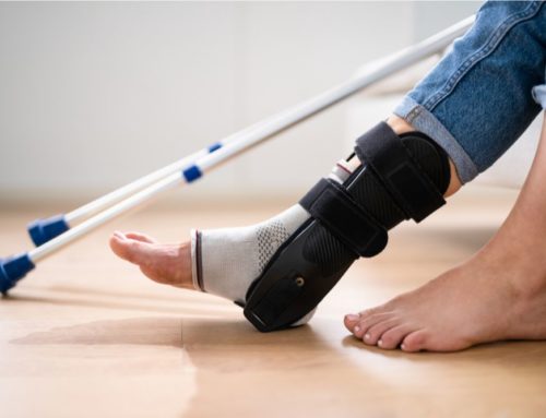 Causes of Delayed Healing After Ankle Surgery